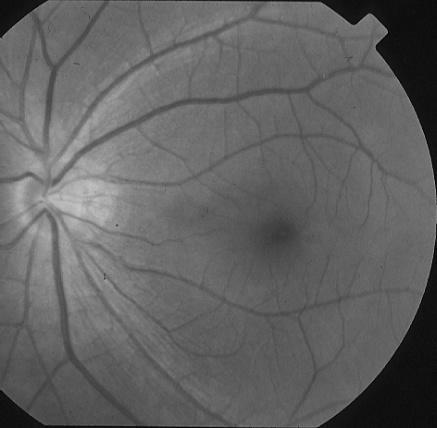 nervose GCL Strato delle cellule