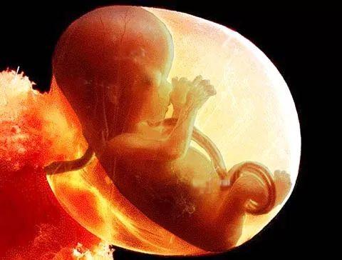 Durante la ricerca sono stati analizzati 140.000 embrioni nell immediato post-concepimento, esami di diagnosi prenatale, feti provenienti da aborti o da morti in utero e neonati vivi.