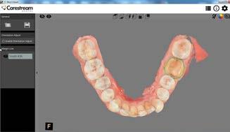 I nostri scanner rendono facile il flusso di lavoro, sia che operiate con un laboratorio odontotecnico sia con una vostra soluzione chairside autonoma nello studio.