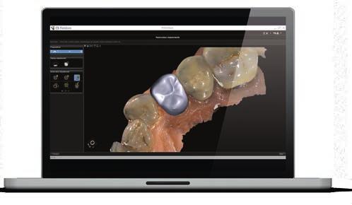 Tutti i file possono essere condivisi facilmente con il laboratorio odontotecnico ed essere visualizzati mediante CS MeshViewer, ottimizzando la comunicazione.