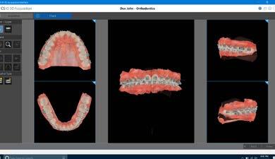 Grazie ai modelli 3D realistici e accurati, potete creare piani di trattamento più accattivanti, incrementandone allo stesso tempo la probabilità di