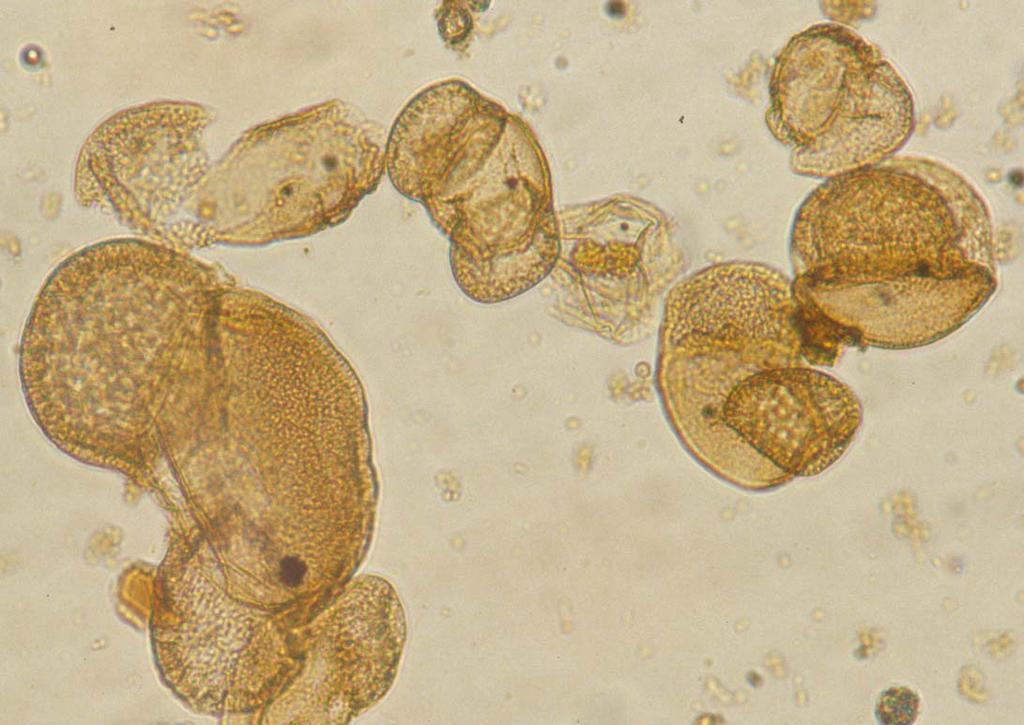 Il polline fossile al microscopio
