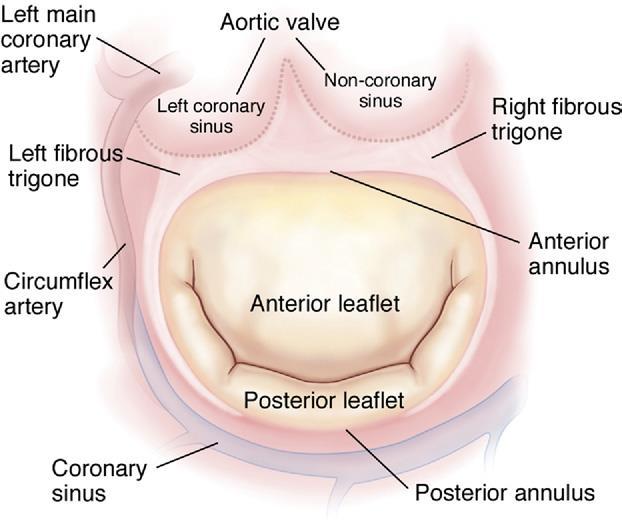 11 valvola tricuspidale (in corrispondenza del setto membranoso atrio ventricolare); il trigono fibroso sinistro è localizzato nel punto di contatto dell anulus mitralico con la base della cuspide