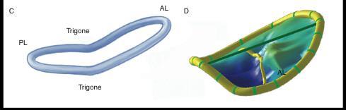 12 Figura 3. Configurazione a sella dell anulus mitralico L anulus ha una area compresa fra i 5 cm 2 e gli 11 cm 2 (di media, 7 cm 2 ), che si modifica durante il ciclo cardiaco.