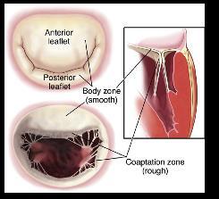 14 Di questi, quello centrale ha la maggior ridondanza, e il suo spessore varia in base all'impatto della pressione sistolica, il che spiegherebbe il motivo per cui è più incline a prolasso e lesioni