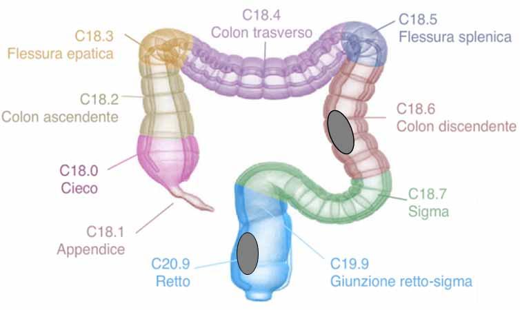 Esempio 1 Due tumori maligni, insorti, uno a livello del colon discendente e l altro al retto sono da considerarsi multipli (incidenti)