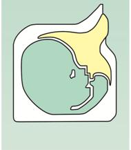 Biological restrictions Capacity to reach blastocyst stage Tecnical restrictions From the embryo, cellular capacity From IVF lab (incubation, embryo culture, handling ) From the embryo From the