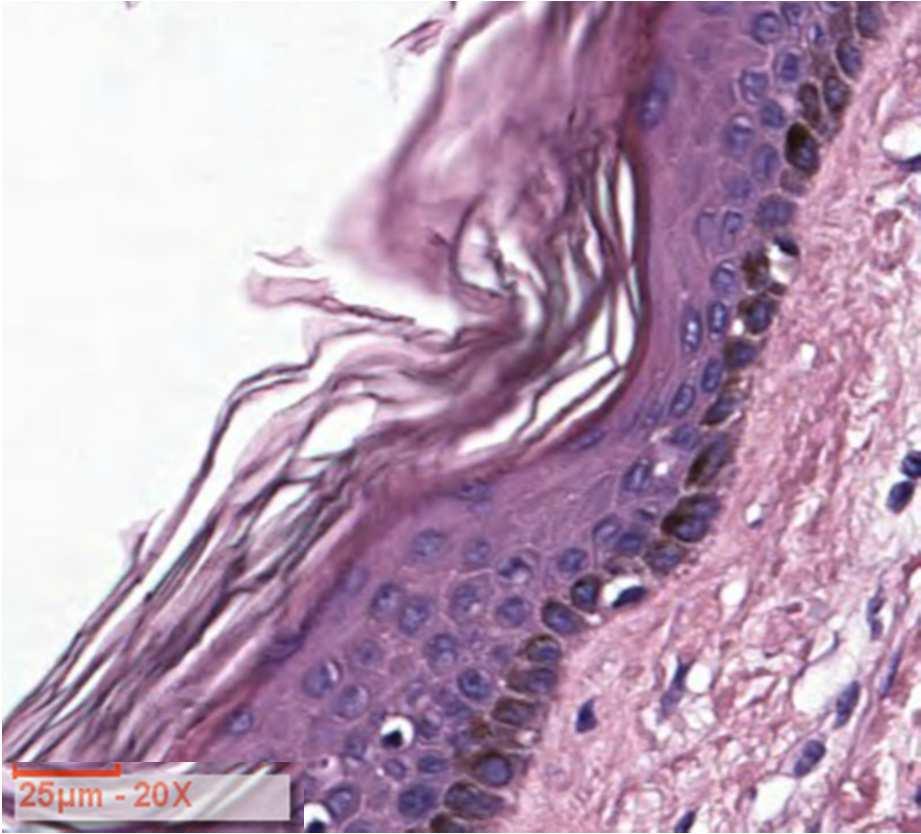 Il melanocita è una cellula derivata dalla cresta neurale che migra nell'epidermide e nei follicoli piliferi durante l'embriogenesi.