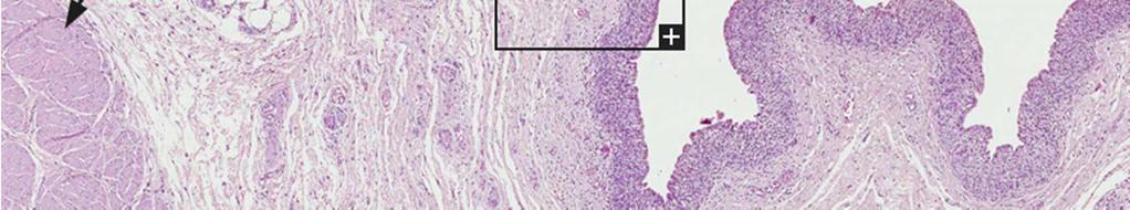 piccole quantità di mucina e sono chiamate cellule ombrello.