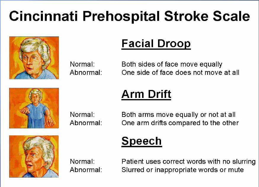 Fase preospedaliera Se confermata la presenza di segni di stroke è necessario allertare il