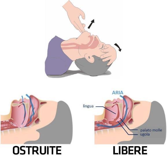 Algoritmo Non risponde e non respira normalmente Chiamare 112/118 30 CTE Non risponde e non respira normalmente 2 ventilazioni Continuare RCP 30:2 Appena disponibile DAE accenderlo e seguire le