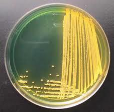 Figura n. 17. Vibrio alginolyticus su TCBS fermenta il saccarosio (colonie gialle). (Foto: http://www.holisticaquaculture.com/uploads/5/3/7/2/5372499/control_of_vibrios_in_ponds_and_on_shrimp.