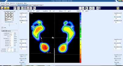 Analisi posturografica 4 Per analisi posturografica si intende una rilevazione simile alla statica ma con tempi di acquisizione (timing) variabili dall'operatore.