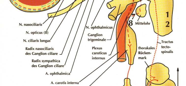 carotidea 1 sindrome di Wallenberg 2