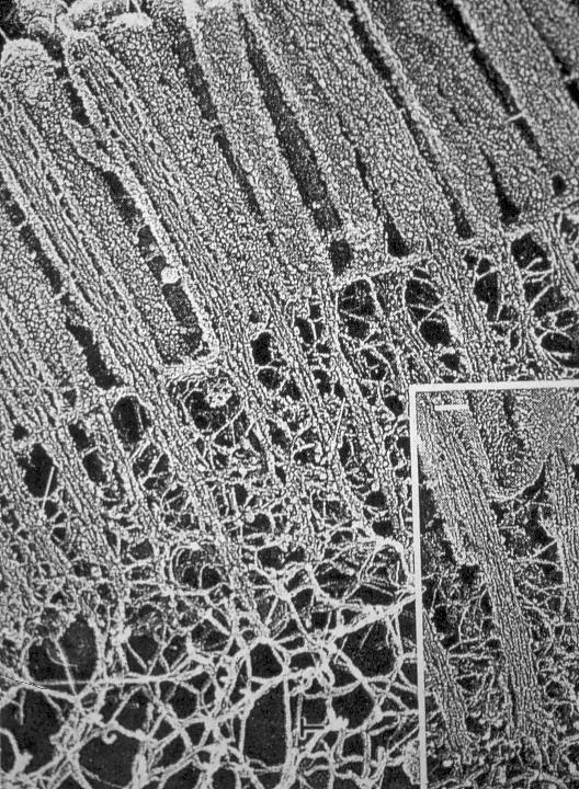 L impalcatura citoscheletrica dei microvilli si continua con il terminal web (trama terminale) una rete contrattile di actina e