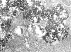 coli survival within epithelial cells 0.0-0.5-1.0 980 U/mg 52 U/mg Cu,ZnSOD - -1.