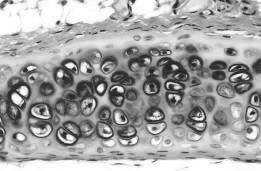 ISTOGENESI Cellule mesenchimali (stellate) si differenziano in condroblasti, cellule più grandi e tondeggianti I condroblasti iniziano a produrre fibre collagene e proteoglicani