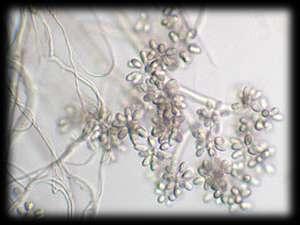 Funghi microscopici Al Regno dei funghi appartengono anche le