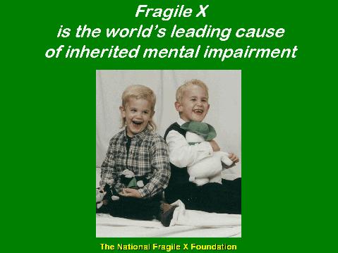 Fragile X