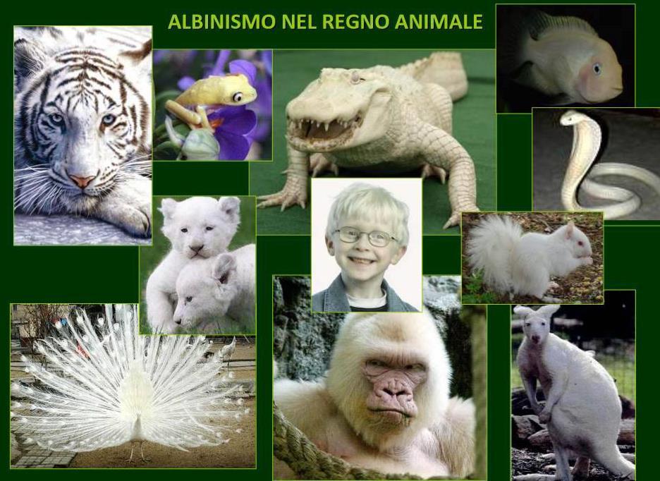 L albinismo è