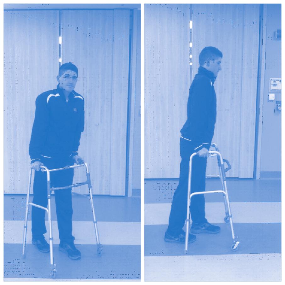 Paziente ancora in grado di camminare stimolare il movimento; accompagnare la persona fornendo gli ausili necessari (deambulatore/bastone/girello).