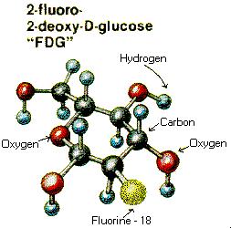 Radioisotopi emettitori di positroni: FDG Il radiofarmaco piu utilizzato in assoluto e il fluoro