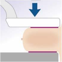 Nel caso in cui il software riesca anche a valutare l area di contatto della mammella, è possibile monitorare la Pressione esercitata, che è considerata un