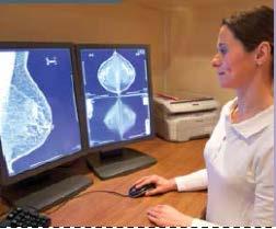 mammografico QA immagine clinica