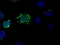 Modello per lo STUDIO DI MUTAZIONI 2005 PHOX2B (wt vs polyala) GFP PHOX2B (wt vs polyala) + promotore gene target 100 N N+C (diffusa) % cells 80 60