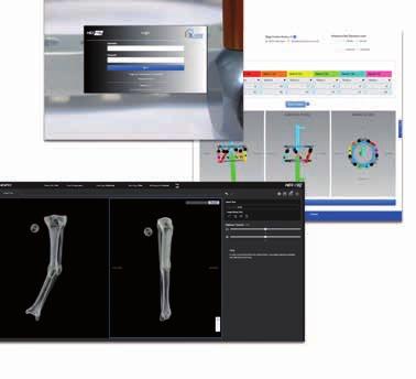 avvalersi di un supporto completo nelle fasi pre/intra e post-operatorie Il modulo integrato