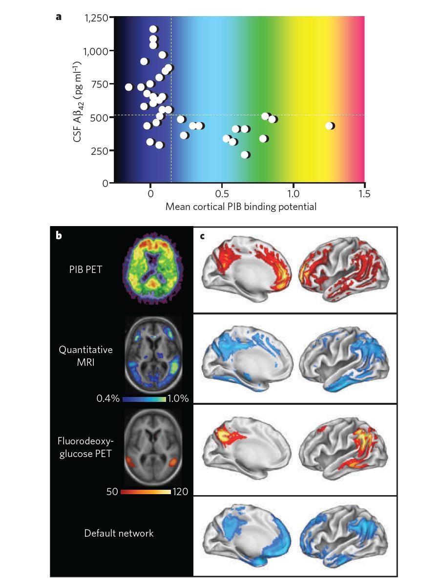 Imaging biomarkers. Perrin RJ et al, Nature 46:916-922, 2010. a) Relationship of PIB PET to cerebrospinal fluid Aβ 42 concentration in cognitively normal individuals.