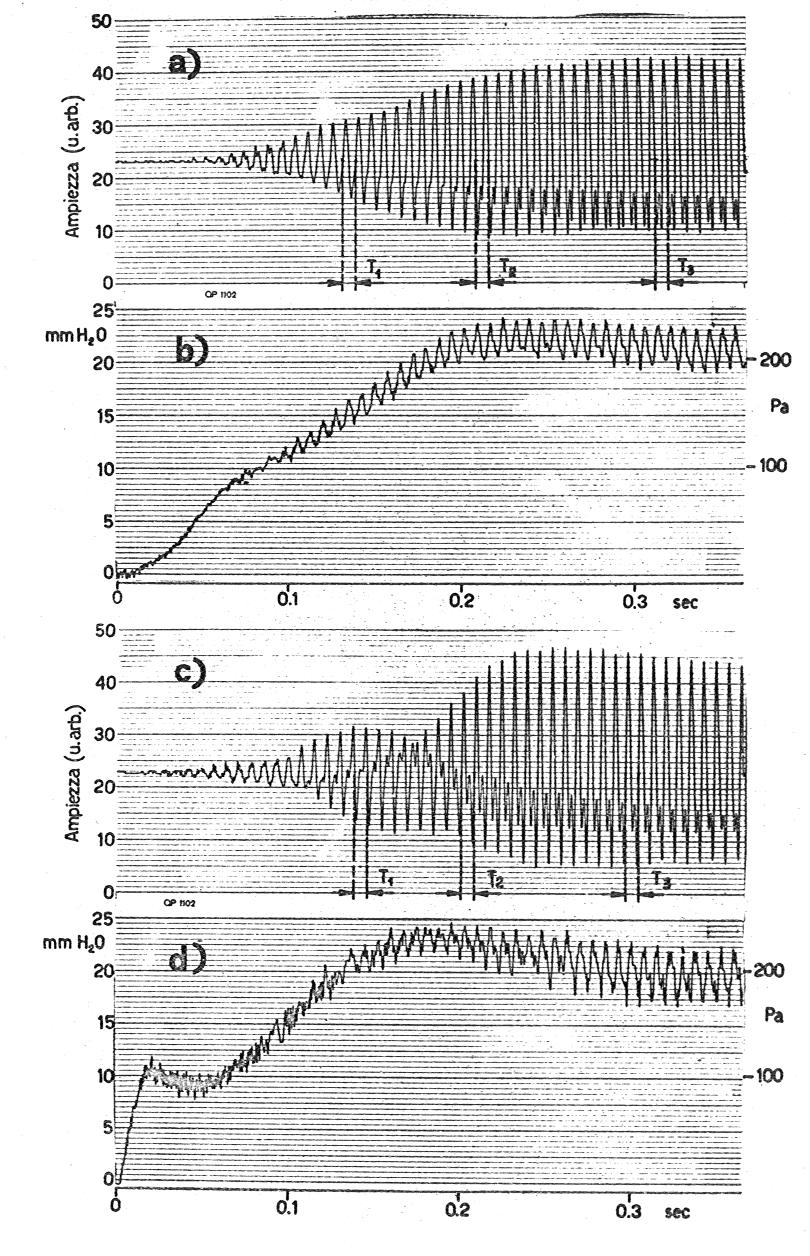 IL SUONO DELL ORGANO E L ACUSTICA DELL AMBIENTE Velocità minima (1975) Il transitorio del suono della canna d