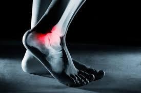 sintomatologiche dolore alla caviglia e al piede 10:30 Analisi differenziale e localizzazione TP