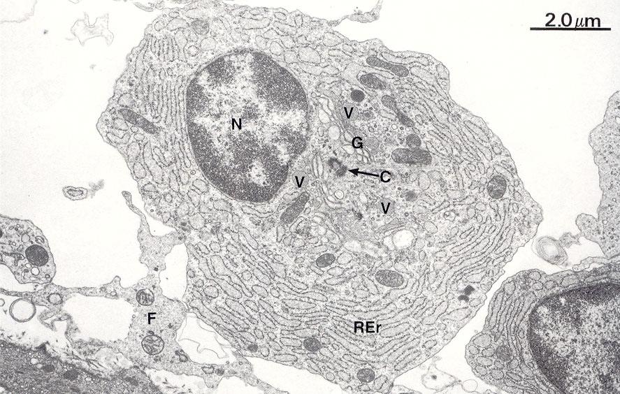 legata alla permanenza dello stimolo antigenico ed alla presenza di fattori di crescita prodotti dalle cellule