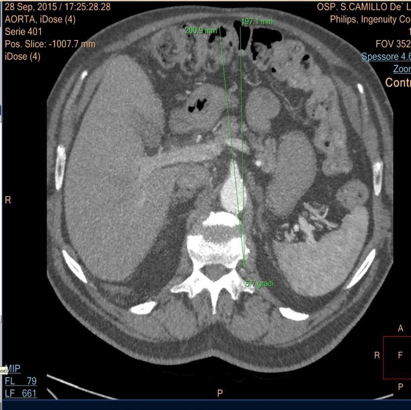 apparecchio angiografico con le