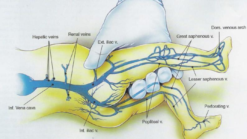 Neonato