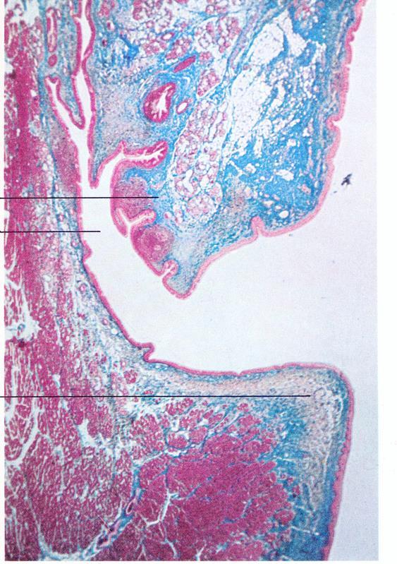 associate alle corde vocali vere abbiamo presenza di tessuto elastico (legamenteo vocale) e muscolatura striata che forma il muscolo vocale SEZIONE FRONTALE MUCOSA DELLA LARINGE EPITELIO RESPIRATORIO