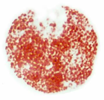 Le cellule del connettivo: i mastociti Il citoplasma è completamente occupato da