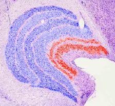 ottico nucleo genicolato laterale