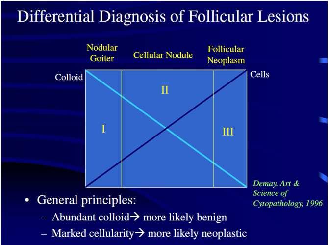 Include il gozzo colloido-cistico, la tiroidite autoimmune (di Hashimoto) e la tiroidite granulomatosa (di De Quervain). Tir 3: Inconclusivo/indeterminato(Proliferazione Follicolare).