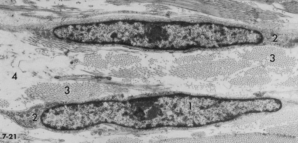 fibrociti al TEM 1. nuclei; 2. poco RER; 3.