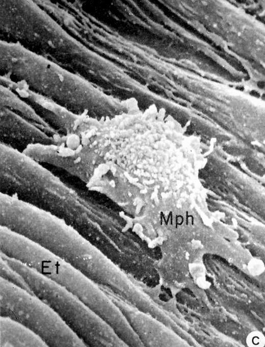 Macrofago (Mph) in movimento sulla superficie di un endotelio (Et) vasale. N.B.