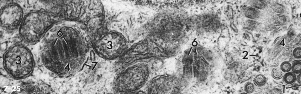 dettagli di un mastocito ribosomi mitocondrio *strutture lamellari