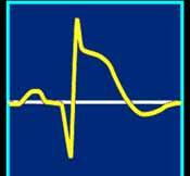 NSTEMI = STEMI