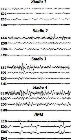 EEG Uguale nell uomo e negli animali