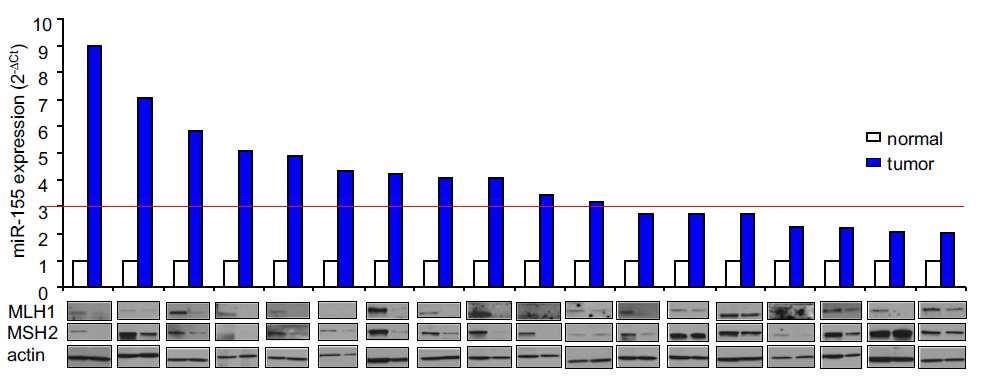 mir-155 expression is inversely