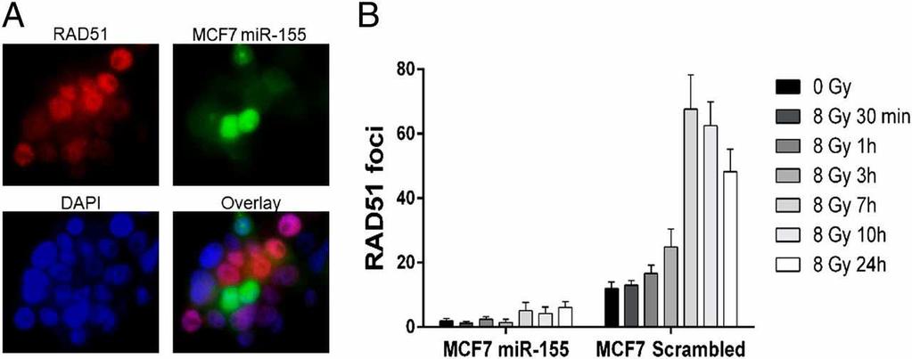 mir-155 inhibits gamma-rays-induced RAD51 foci formation.