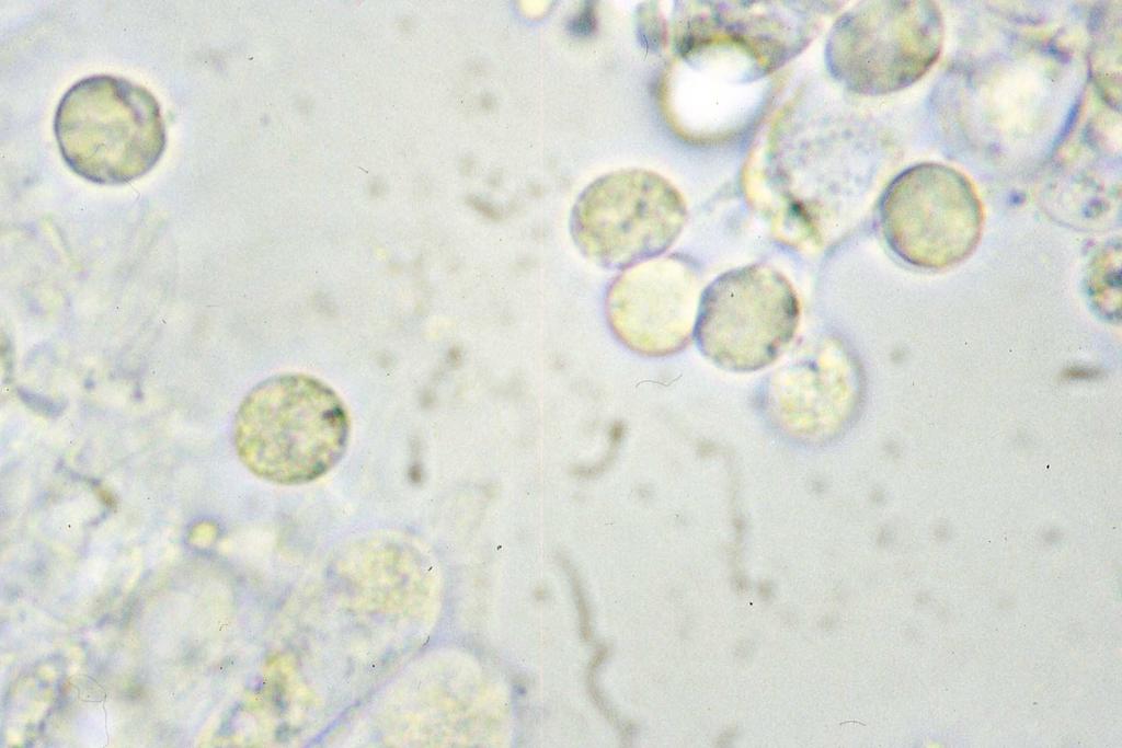 Considerato che, spesso, nell ambito dei Generi o delle Sezioni, le caratteristiche delle spore risultano simili per forma, grandezza e reazioni microchimiche, l indagine microscopica il più delle