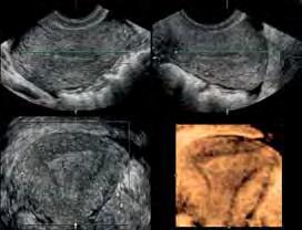 consentono di ottenere in un ampia gamma di applicazioni cliniche un eccezionale sensibilità, penetrazione e risoluzione del mezzo di contrasto.