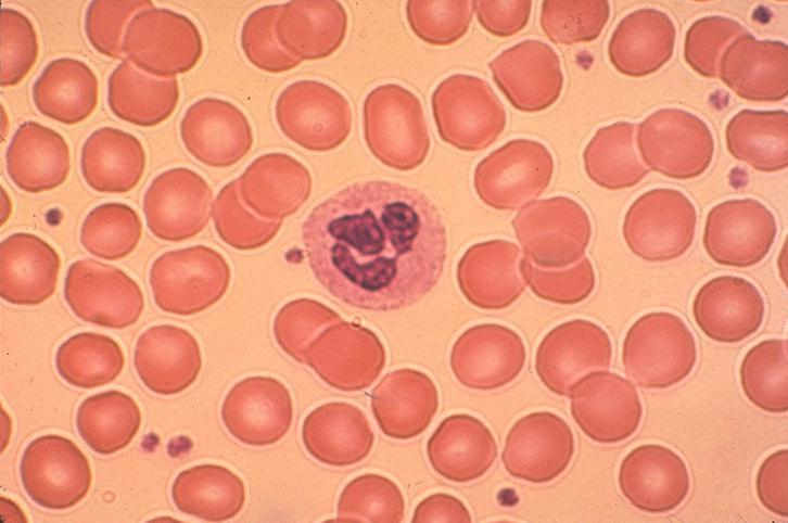 Neutrofili -cellule